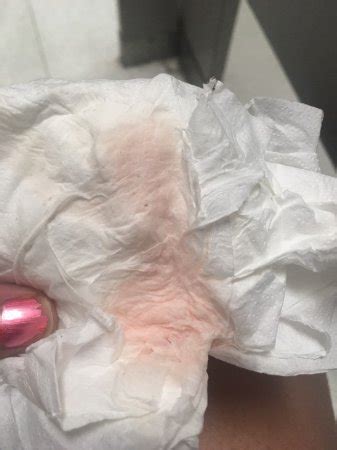 Light pink on toilet paper. Things To Know About Light pink on toilet paper. 